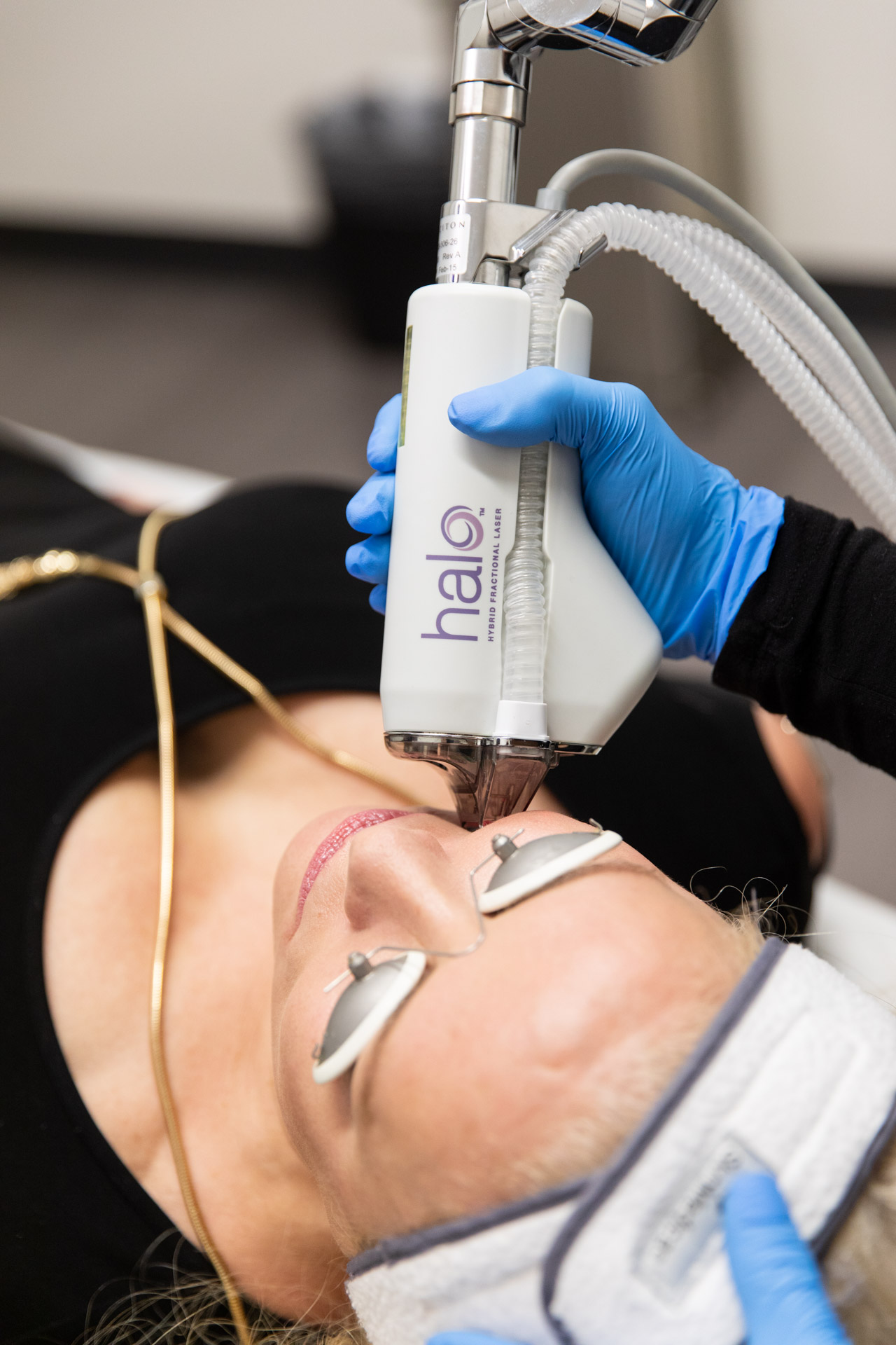 Medical Aesthetics and Laser Halo