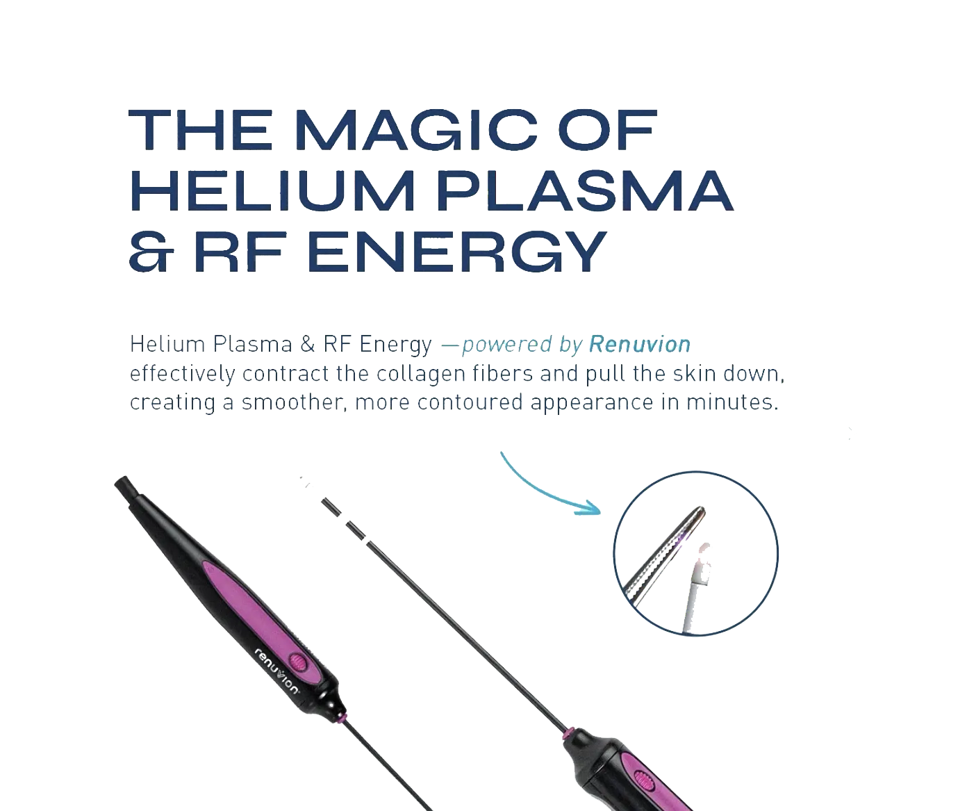 Renuvion skin tightening technology