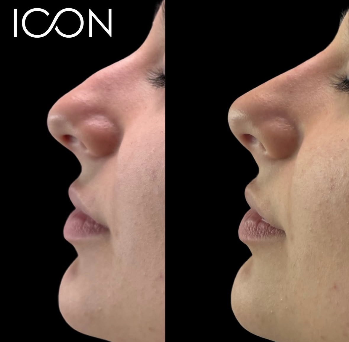 Facial Balancing