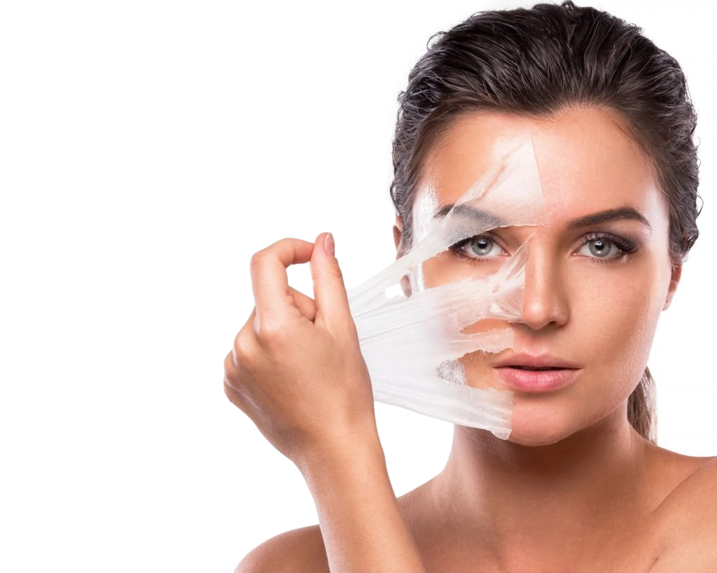 VI Chemical Peels