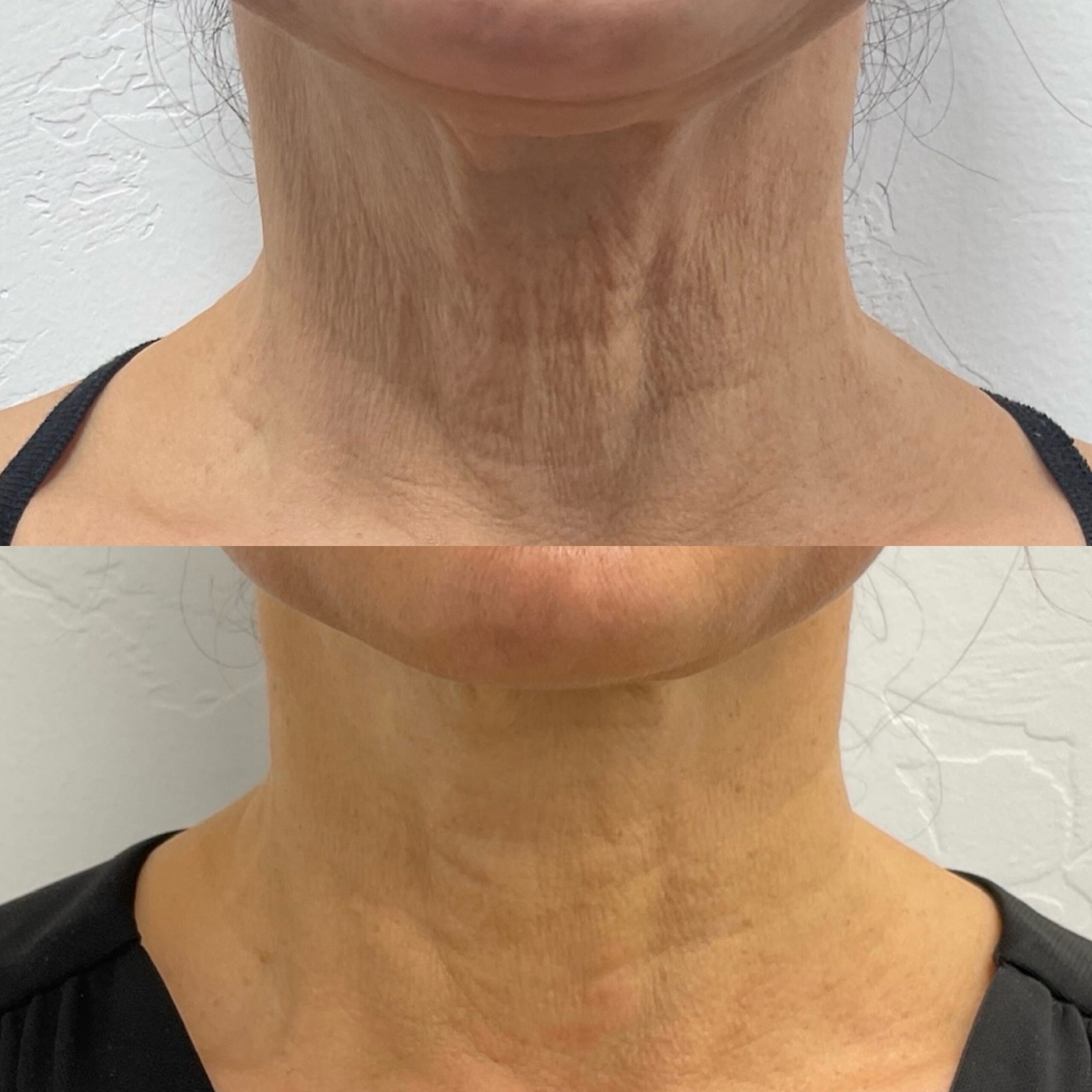 Skin Treatment Image