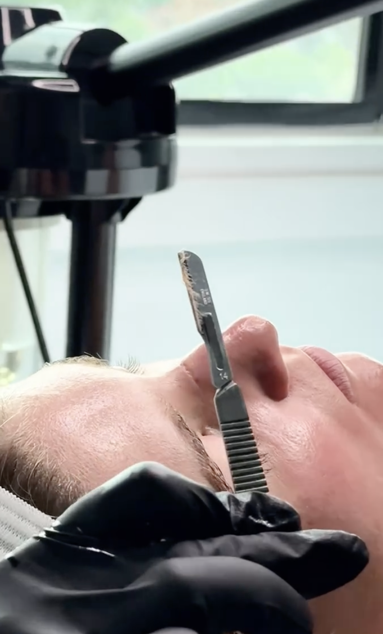 Dermaplaning Facial