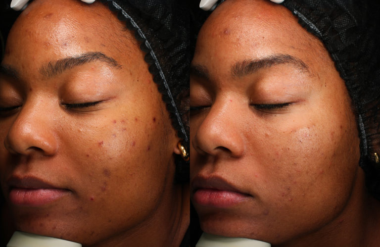 Enlighten Peel